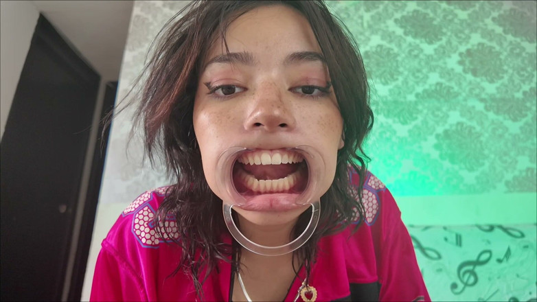 KiyuSweetCrazy: Cheeks Pulled Apart Teeth Exposed