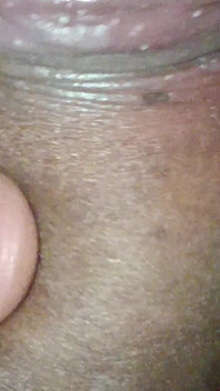 Urine Infection