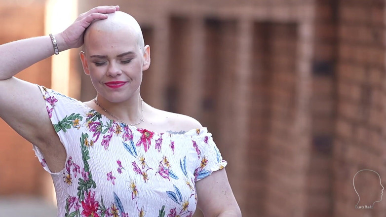 Euro Bald: Emily