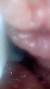 Endoscope Camera Shows the Most Sensitive Parts of the Penis Educational Video