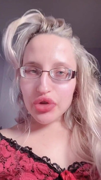 Lip obsession plaagt