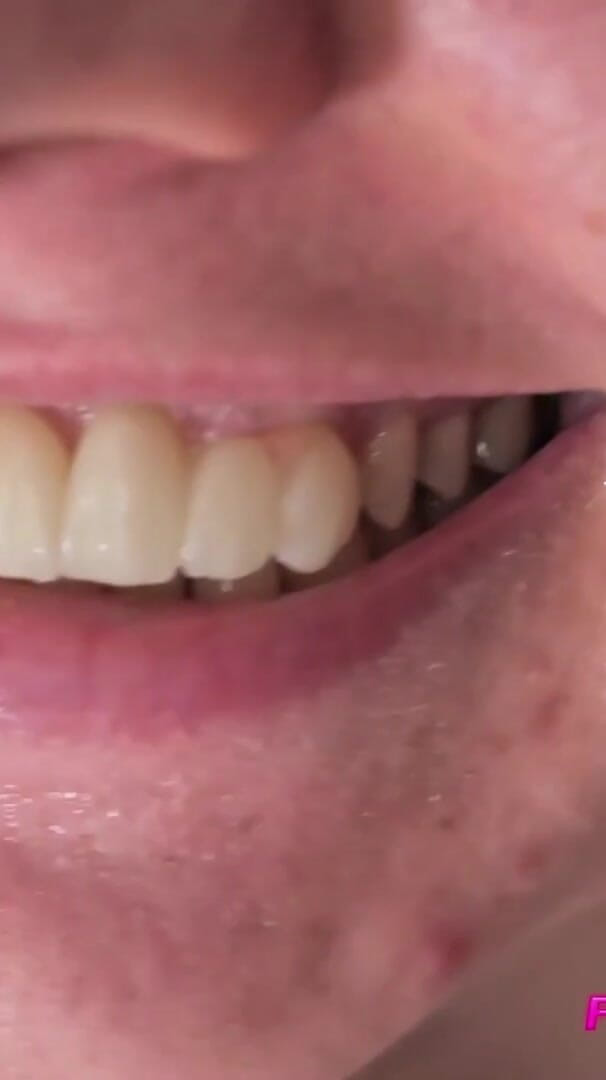 MILF Opened Mouth with Cumshot in It, She Says She Loves It and Swallow It (Pervert Couple)