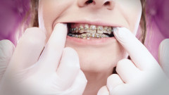 Arya Grander: ASMR: vylepšené rovnátky s řetězovými gumovými pásky a nitrilovými rukavicemi (Arya Grander)