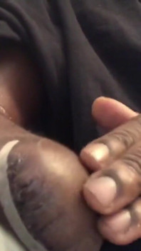 Amputee Stroking Armstump