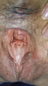 Wide Open Pusy, See My Cervix