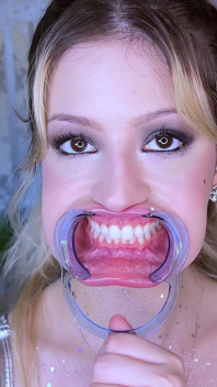 Esame dentale estremo fetish dei denti