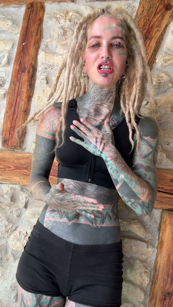 Anuskatzz: Día 5 Después De Mis Tetas Y Cirugía De Blefoplastia Superior