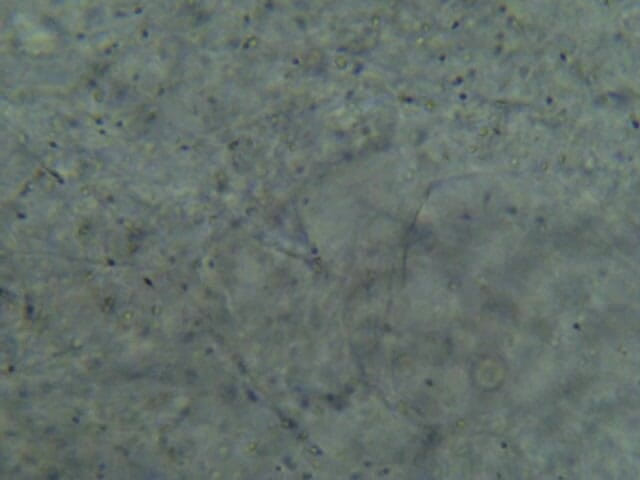 Stickman: Alla älskar spermier