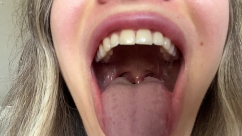 Rarible Diamond: Raksasa