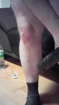 Anal-sesion