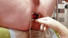 Marcus Pollack: Espéculo estiramiento para subs agujero