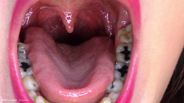 Scarlet Vixen: Uvula uốn &amp; rung