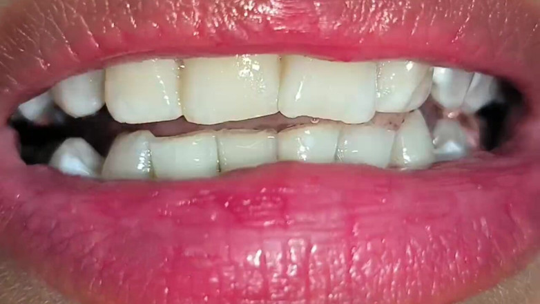 Isabel: Snake Gum