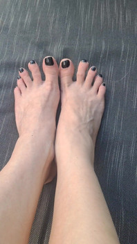 Do We See How Beguiled My Throbbing Foot Veins Are