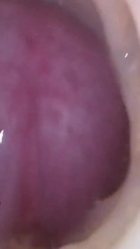 Bir litre sperm acısı