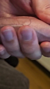 Neobřezaný zakřivený penis