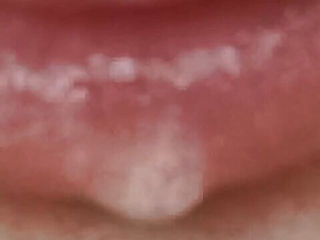 Sperm Condom in My Mouth (Xhamster stroks)