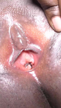 Virgin Teen Pussy with Hymen Exposed