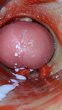 Kamera Uvnitř Hluboké Kundičky Zachycuje Předávkování Ejakulace Spermatu Asmr