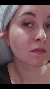 My ear cleaning routine starts with cotton swabs and then gauze.