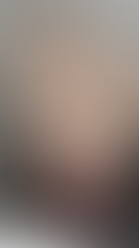 I'm Filming My Huge Hanging Anal Prolapse on a Webcam