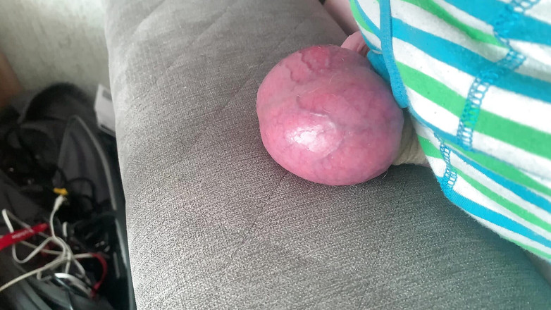 Stuey75: Duro rompiendo bolas