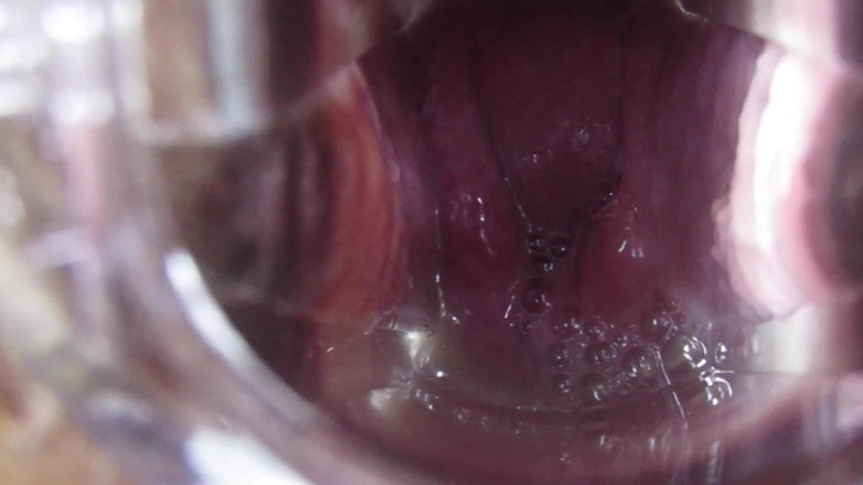 VeeVee Vixen: Výstřik děložního čípku Inseminace