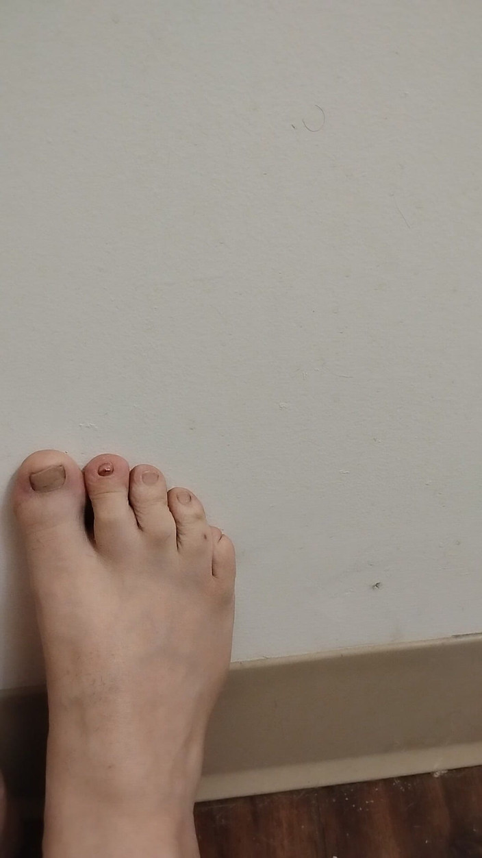 JG Risk: 2025年11月26日 かわいい小さなつま先たち