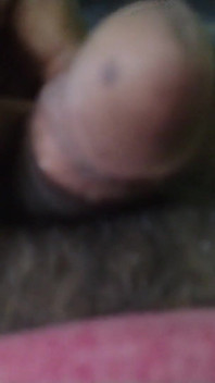 Mój penis z pieprzykiem