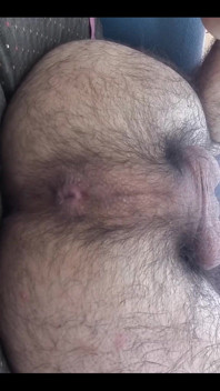 My Asshole in Close-up