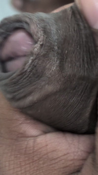 Masturbation, Gros Plan