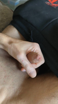 Masturbation