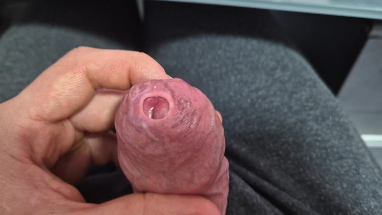GloomyChase977: Kulup phimosis sempit menganga dengan mani muncrat!