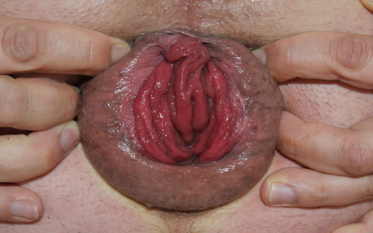 Father's Day 2025 - Open Hole Day! (Buxte extreme)