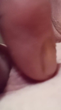 Nipples