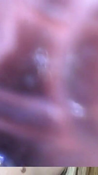 Endoskopi!! Giantess Menelan 25 Anggota Sekali lagi