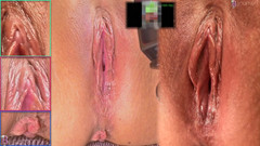 Bijoumon: Upphetsande svar xperimental