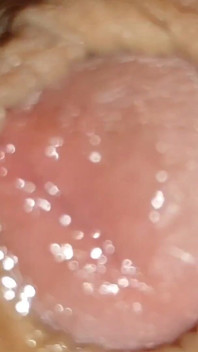 Grote Geile Anale Phimosis Jongen!