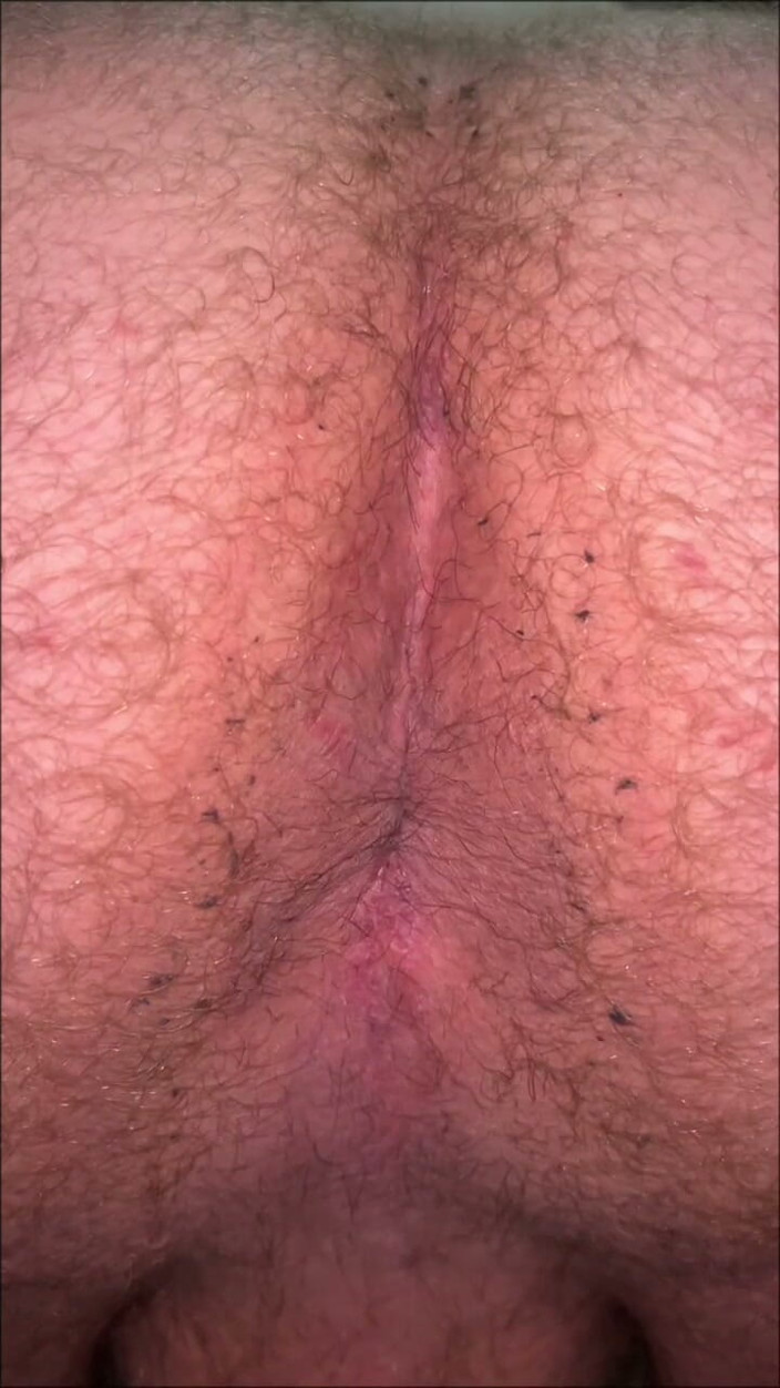 Makssssimus: Dirty Fatass Ass and a Tiny Dick