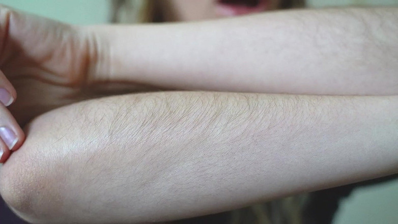 Rarible Diamond: 毛茸茸的前臂定制