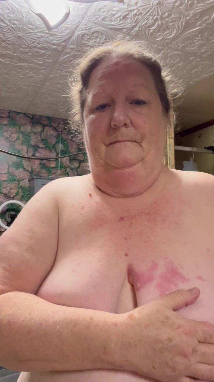 PlayfulRose1: Kes Buruk Shingles