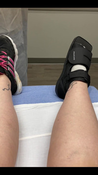 Welp, I messed up my foot