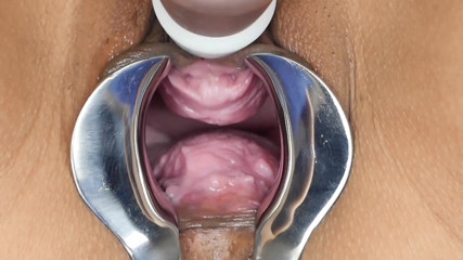 SexyThai1987: Speculum - have a look deep inside me