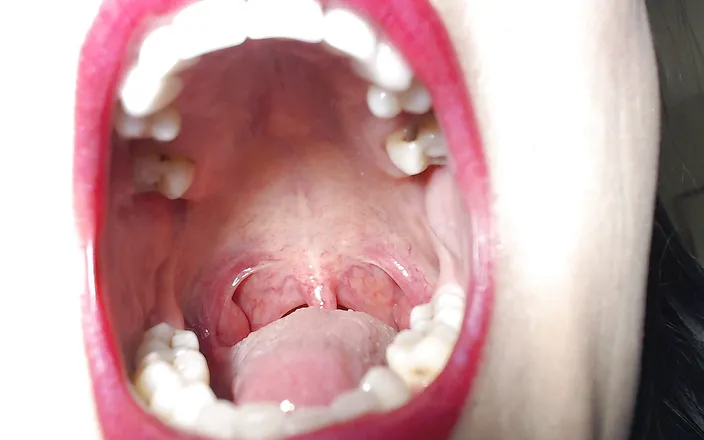 Abby Anna: Big wide open mouth