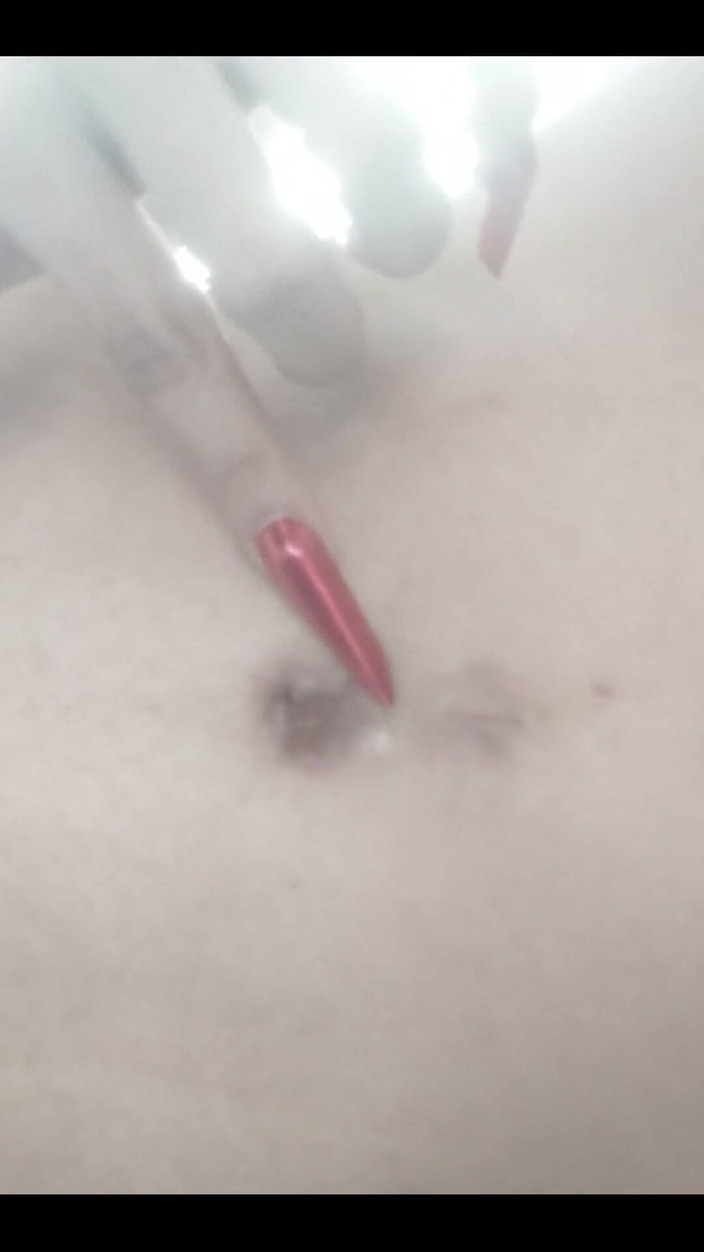 Anakaliyah: Bříško, Přichází tuck