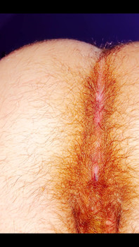 Hairy Butt of a 5-month Pregnant Woman