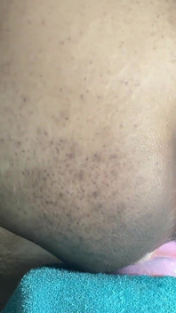 Xl Butt Plug ničí můj zadek