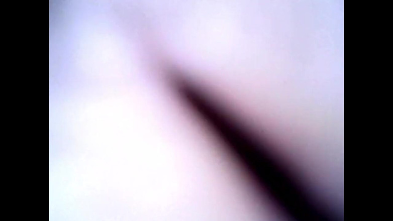 Idmir Sugary: Endoscope Details - Hole Balls Cock Foreskin Belly Nipples Mouth Sperm