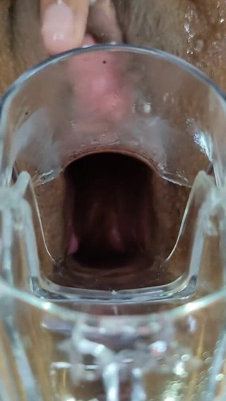 Xamy_97: Espansione anale con speculum