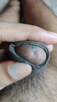 My Penis
